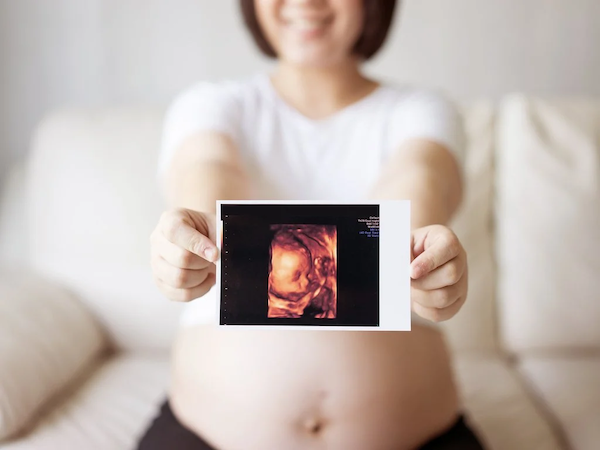 Tại sao siêu âm thai nhi tuần thứ 23 lại là cột mốc quan trọng?